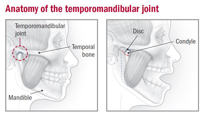 Tmj Temporomandibular Joint And Muscle Disorders The Dental Arcade
